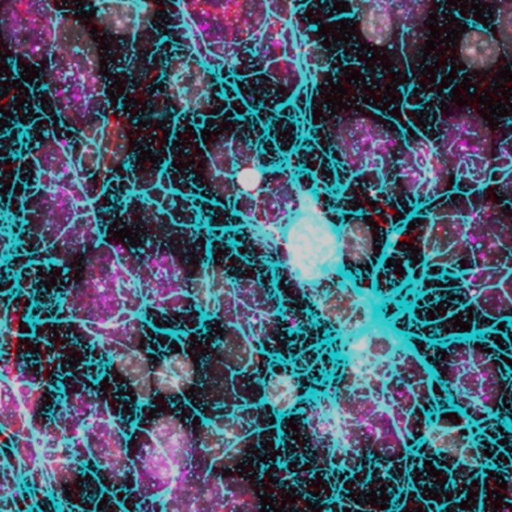 High magnification microscopy image of the stroked brain of a common marmoset showing neurons (magenta) and a branched microglial cell (cyan) whose processes pass by a dead nucleus (white). Credit: Amanda Sierra.