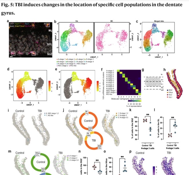 New Study Unveils Mechanisms of Brain Alterations Following Traumatic ...